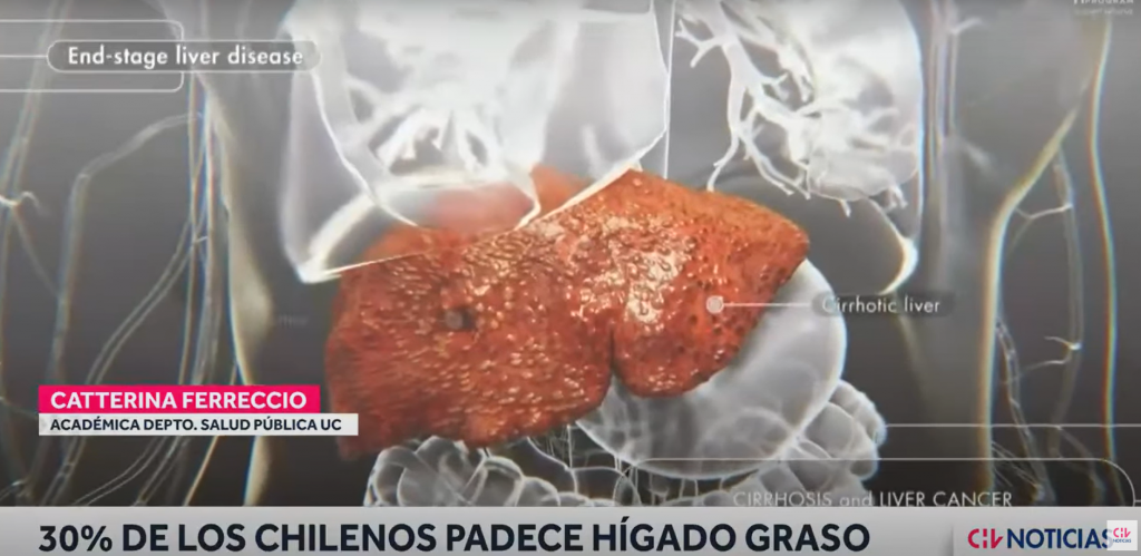 EL 30% DE LOS CHILENOS PADECE HÍGADO GRASO: PUEDE CAUSAR CÁNCER O CIRROSIS EXPLICÓ LA DRA. CATTERINA FERRECCIO - Cáncer